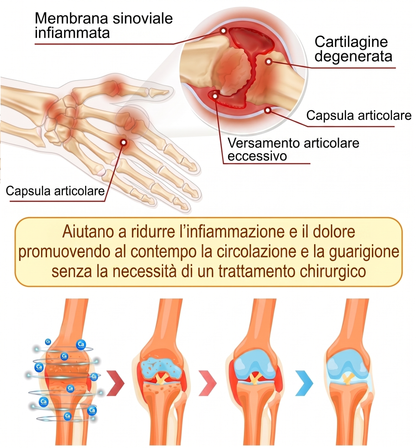 Sconto del 30% 🎁🎁 | Crema 𝐌𝐔𝐑𝐖𝐎𝐍® al veleno d’api per alleviare il dolore e favorire la rigenerazione ossea ✨✨✨ (Specialmente per gli anziani)