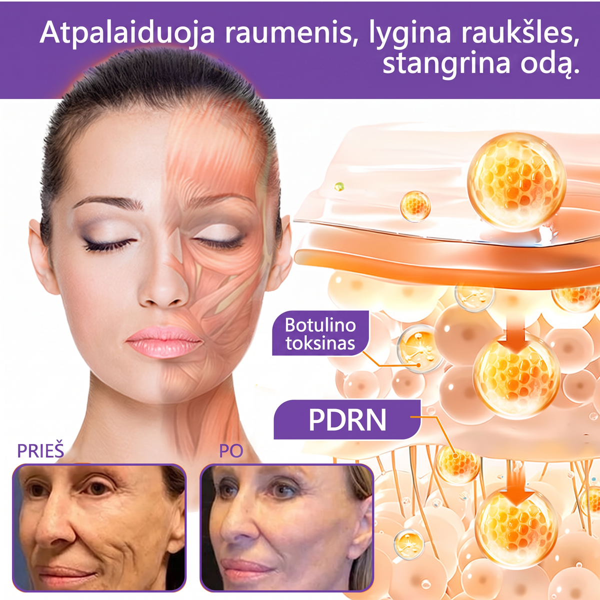 Ekspertų rekomenduojama🥦 |🌥️Vitalisys® PDRN“daugiapeptidis masažuojamasis kūno kremas – Anti-senėjimo, drėkinamasis,stangrinamasis,odą regeneruojantis,sulyginantis,spuogų ir dėmių šalinimo,karpų ir apgamų šalinimo, psoriazės palengvinimo priemonė.💙