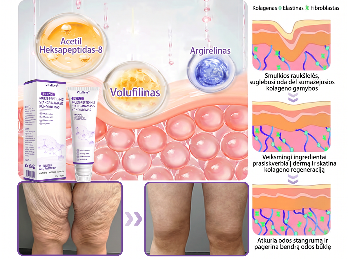 Ekspertų rekomenduojama🥦 |🌥️Vitalisys® PDRN“daugiapeptidis masažuojamasis kūno kremas – Anti-senėjimo, drėkinamasis,stangrinamasis,odą regeneruojantis,sulyginantis,spuogų ir dėmių šalinimo,karpų ir apgamų šalinimo, psoriazės palengvinimo priemonė.💙