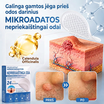 👩‍⚕️💯 Oficiální obchod | MURWON® 🌥️ Mikrojehličková náplast pro odstranění kožních nedokonalostí (Pro kožní výrůstky, drobné kožní útvary, bradavice, mateřská znaménka, stařecké skvrny a pigmentové nepravidelnosti.)🐮
