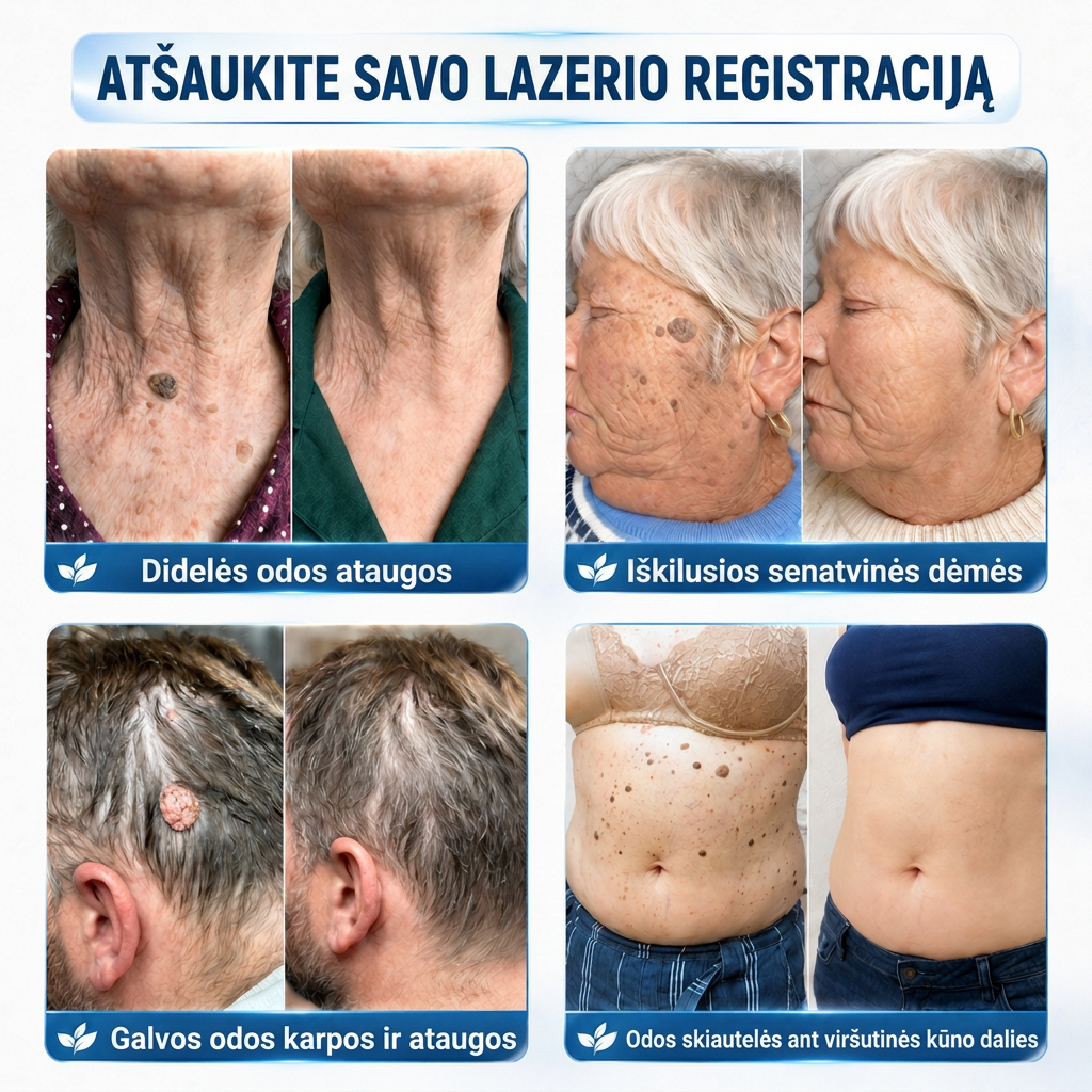 👩‍⚕️💯 Oficiální obchod | MURWON® 🌥️ Mikrojehličková náplast pro odstranění kožních nedokonalostí (Pro kožní výrůstky, drobné kožní útvary, bradavice, mateřská znaménka, stařecké skvrny a pigmentové nepravidelnosti.)🐮