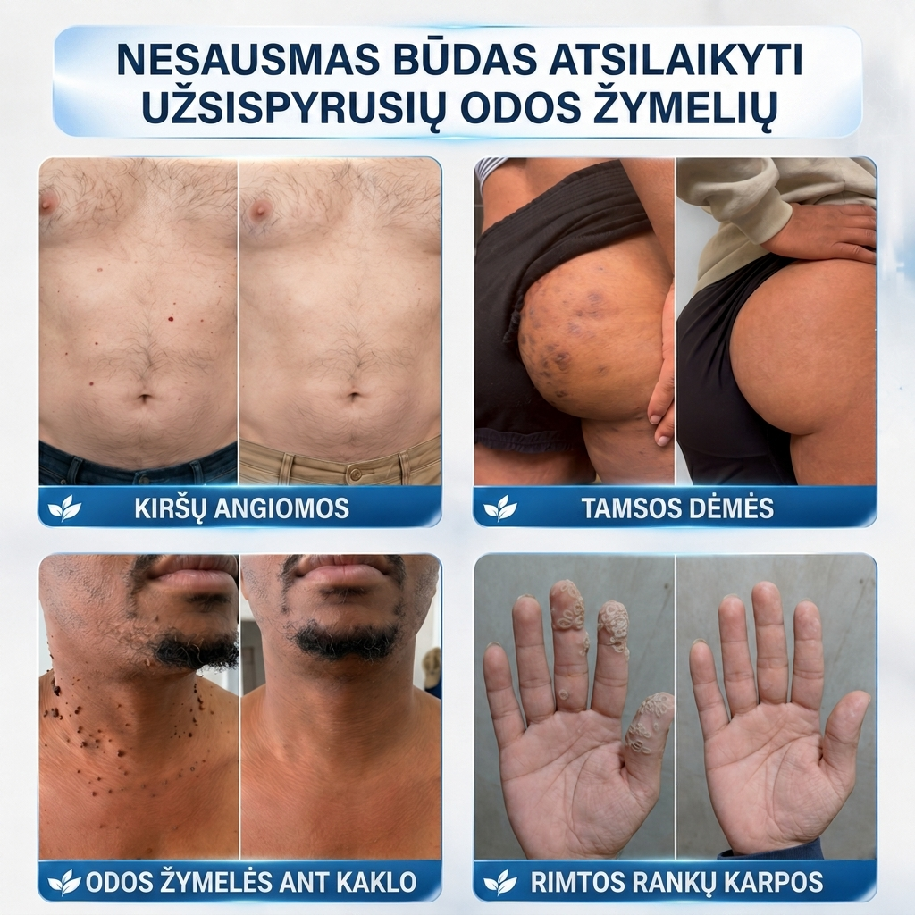 👩‍⚕️💯 Oficiální obchod | MURWON® 🌥️ Mikrojehličková náplast pro odstranění kožních nedokonalostí (Pro kožní výrůstky, drobné kožní útvary, bradavice, mateřská znaménka, stařecké skvrny a pigmentové nepravidelnosti.)🐮