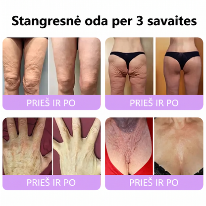 Ekspertų rekomenduojama🥦 |🌥️Vitalisys® PDRN“daugiapeptidis masažuojamasis kūno kremas – Anti-senėjimo, drėkinamasis,stangrinamasis,odą regeneruojantis,sulyginantis,spuogų ir dėmių šalinimo,karpų ir apgamų šalinimo, psoriazės palengvinimo priemonė.💙