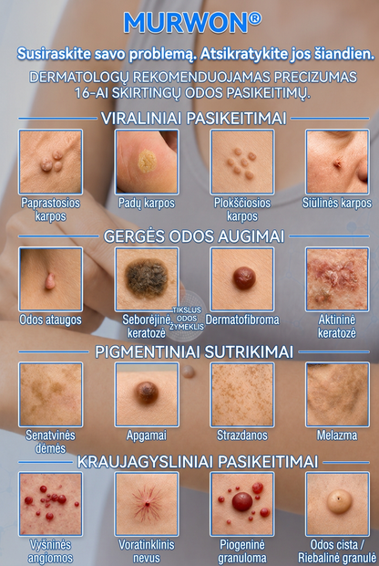 👩‍⚕️💯 Oficiální obchod | MURWON® 🌥️ Mikrojehličková náplast pro odstranění kožních nedokonalostí (Pro kožní výrůstky, drobné kožní útvary, bradavice, mateřská znaménka, stařecké skvrny a pigmentové nepravidelnosti.)🐮