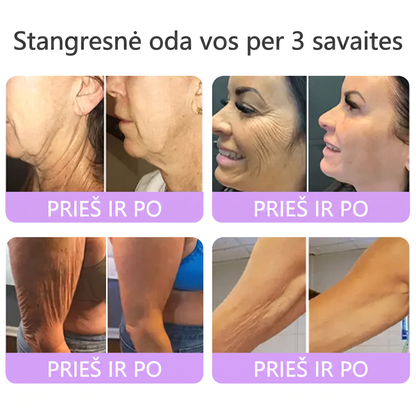 Ekspertų rekomenduojama🥦 |🌥️Vitalisys® PDRN“daugiapeptidis masažuojamasis kūno kremas – Anti-senėjimo, drėkinamasis,stangrinamasis,odą regeneruojantis,sulyginantis,spuogų ir dėmių šalinimo,karpų ir apgamų šalinimo, psoriazės palengvinimo priemonė.💙