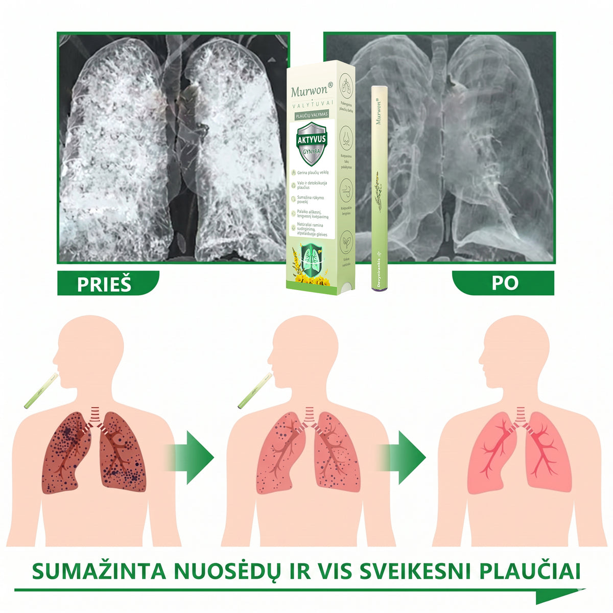 🇱🇹 Aukštos kokybės lietuviškas produktas, pristatymas visoje šalyje 🥇 Murwon® vaistažolių plaučių valymo inhaliatorius 🍇(👨‍⚕️ Pagalba kosulio, uždegimo, dusulio, skrepliavimo, nosies užgulimo, bronchito, alergijų ir plaučių problemų atveju) ❤️
