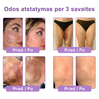 Ekspertų rekomenduojama🥦 |🌥️Vitalisys® PDRN“daugiapeptidis masažuojamasis kūno kremas – Anti-senėjimo, drėkinamasis,stangrinamasis,odą regeneruojantis,sulyginantis,spuogų ir dėmių šalinimo,karpų ir apgamų šalinimo, psoriazės palengvinimo priemonė.💙