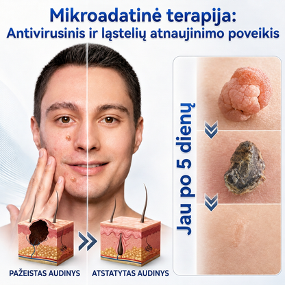 👩‍⚕️💯 Oficiální obchod | MURWON® 🌥️ Mikrojehličková náplast pro odstranění kožních nedokonalostí (Pro kožní výrůstky, drobné kožní útvary, bradavice, mateřská znaménka, stařecké skvrny a pigmentové nepravidelnosti.)🐮